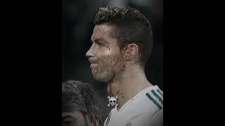 Players with Scars ️