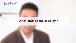 What causes facial palsy in the majority of cases?