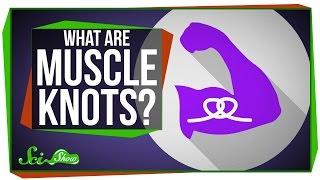 What Are Muscle Knots?