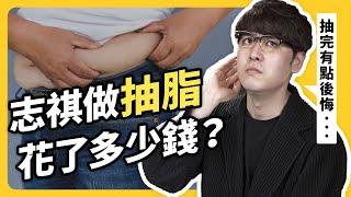 「抽脂」其實不是減肥手術？哪些人不能抽脂？有什麼副作用？ft. 林子宇醫師｜志祺七七