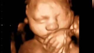 3D Ultrasound video clip made by 3D Sono Image in Coquitlam BC  www.3dsonoimage.com