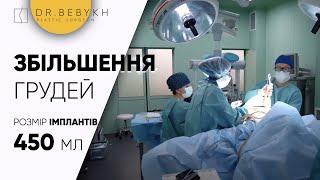 Збільшення грудей імплантнами. Олександр Бебех