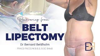 Recovering form a belt lipectomy