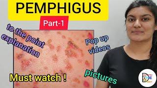 SKIN LESIONS- PEMPHIGUS PART-1