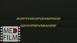 Аортокоронарное шунтирование, академик Г.М.Соловьев © Сoronary artery bypass surgery