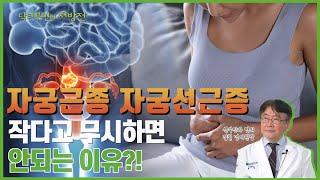 자궁근종, 자궁선근증 작다고 무시하면 안되는 이유?! [Ep.20.자궁근종,자궁선근증]