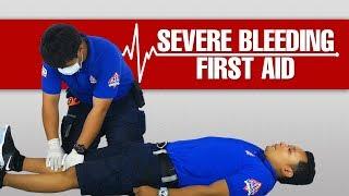 What to do to Help a Person Suffering with Severe Bleeding #Lifesaver