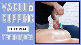 Cupping Massage - Back Treatment