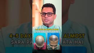 How long does the pain last after a hair transplant? | Explained by Dr Jangid | #shorts