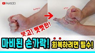 뇌졸중 뇌경색 뇌출혈로 마비된 손가락 회복하려면 필수시청! Recovering Stroke Fingers