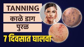 ७  दिवसात दूर होतील चेहऱ्यावरील डाग, काळपटपणा | 7 Days Challenge | Remove Dark Spots |Skin care Tips