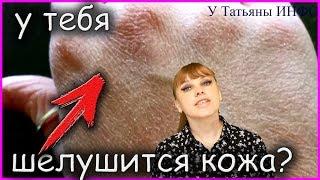 У тебя ШЕЛУШИТСЯ КОЖА на РУКАХ? Как избавиться от шелушения кожи?