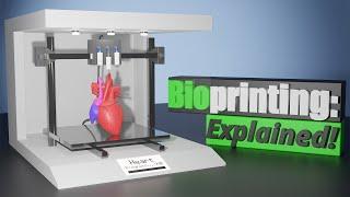 What 3D Bioprinting Is and How It Works