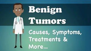 Benign Tumors - Causes, Symptoms, Treatments & More…