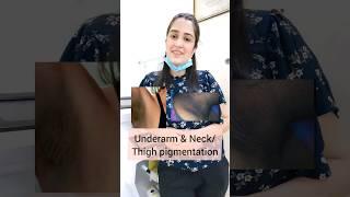 Dark underarms and Dark neck treatment by @drkratikamohan #shorts