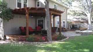 Austin Outdoor Living - Before & After - 11 - New Patio, Pergola, Firepit, Deck