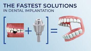 The fastest solutions in dental implantation. New technologies in the dental industry. Healing &time