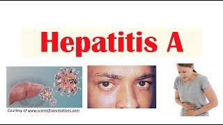 Hepatitis A  | Virus, Risk Factors, Pathophysiology, Signs & Symptoms, Diagnosis, Treatment