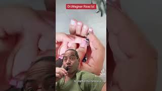 GADGET USED FOR BRACHYMETATARSIA SURGERY#shorts #brachymetatarsia