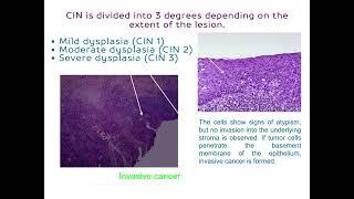 1. Diseases of the female genital organs and mammary glands