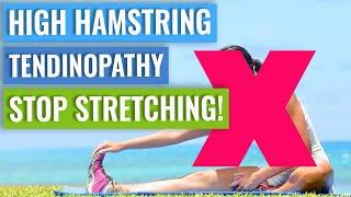 High Hamstring Tendinopathy - DON'T Stretch It!