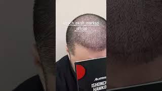 SOCH QOSH SOQOL EKISH MARKAZI TURKIYA TEXNOLOGIYA ASOSIDA EKAMIZ ️97 000 48 98