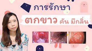 รู้ลึกเรื่องตกขาว อาการ การรักษา ครบจบในคลิปเดียว | หมอยาพาคุย