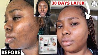 30 Days using Bodyshop Drops of Light range for clear skin - REAL RESULTS *Not Clickbait*