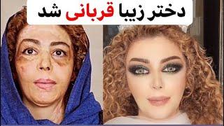 بادکنک تولد باعث انفجار شد | میکاپ سوختگی | کاترین آریازند#makeup