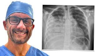 How I Read a Chest X-ray!