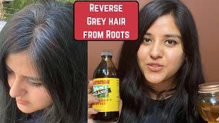 Black Hair Permanently | Reverse Grey Hair Naturally | Ayurvedic Turai Oil | Premature Greying