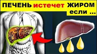 КАК ОЧИСТИТЬ ПЕЧЕНЬ от ЖИРА ? Жировой гепатоз как лечить ?