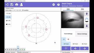 Operating Henson 9000's rapid and intelligent screening test: Smart Supra Multiple Stimulus Test