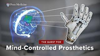 Thought-Controlled Prosthetics: A Brain-Computer Interface Breakthrough