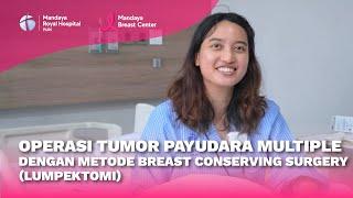 Testimoni Pasien Lakukan Pengangkatan Tumor Payudara Multiple di Mandaya Royal Breast Center