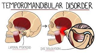 Temporomandibular Joint Disorder Explained (TMJ Dysfunction) | Includes Treatment & Anatomy