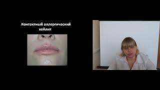 Хейлиты
