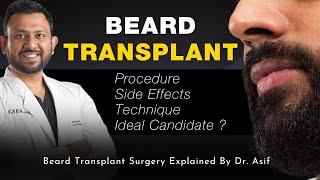 Beard Transplant Procedure | Technique | Side Effects | Ideal Candidate ? Explained By Dr. Asif