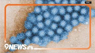 Norovirus outbreak numbers have tripled in Colorado