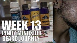 Week 13 Pinoy Minoxidil Beard Journey - Kirkland Minoxidil 5%