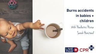 Burns accidents in babies + children