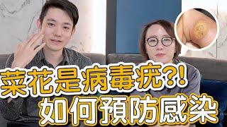 病毒疣會傳染怎麼辦？莊盈彥醫師跟蕭全佑醫師教大家如何治療及預防！