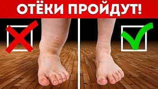 НОГИ больше не будут ОТЕКАТЬ! / ЭФФЕКТИВНОЕ лечение отеков ног