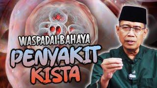 WASPADAI BAHAYA PENYAKIT KISTA