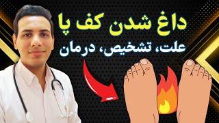 درمان فوری داغی کف پا | Immediate treatment for hot feet