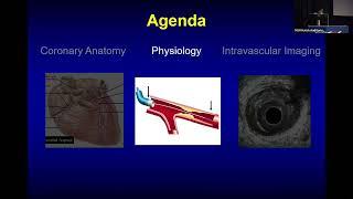 Annapoorna S  Kini, MD   Coronary Anatomy  Physiology and Imaging