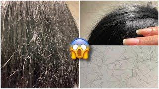 COMO ACABAR DE VEZ A QUEBRA DE CABELO SEM CORTAR | RECUPEREI MEU CABELO!