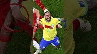 Neymar's Worst Injury 2 #football #soccer #neymar