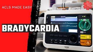 ACLS Bradycardia Algorithm