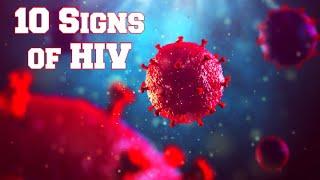 10 Signs of HIV 